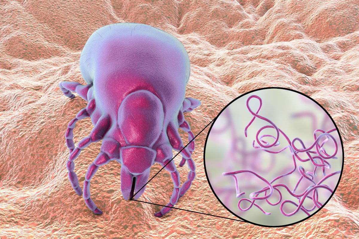Maladie de Lyme Tique Borrelia burgdorferi